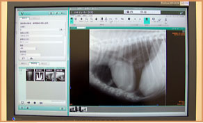 コンピューターＸ線画像システム